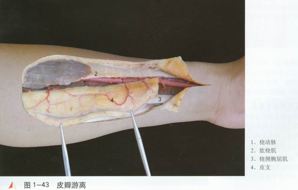 手术图库                          图1—39  应用解剖     桡动脉[1