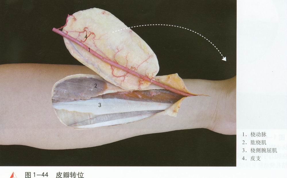 手术图库                          图1—39  应用解剖     桡动脉[1