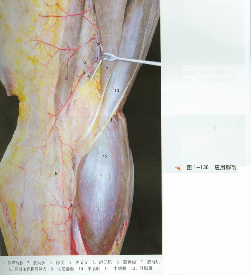 教学 69 手术图库 图1—138 应用解剖